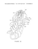 PEDICLE GUIDED RETRACTOR SYSTEM diagram and image