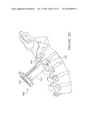 PEDICLE GUIDED RETRACTOR SYSTEM diagram and image