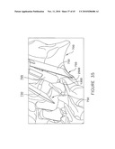 PEDICLE GUIDED RETRACTOR SYSTEM diagram and image