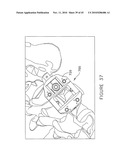 PEDICLE GUIDED RETRACTOR SYSTEM diagram and image