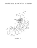 PEDICLE GUIDED RETRACTOR SYSTEM diagram and image