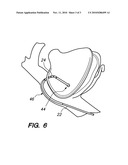 MULTI-BEND STEERABLE MAPPING CATHETER diagram and image