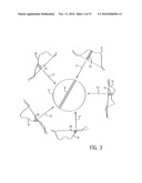 Contrast Enhanced MRA With Highly Constrained Backprojection Reconstruction Using Phase Contrast Composite Image diagram and image