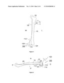 TOOL FOR DETECTING PLANES OF A BONE AND ASSIGNED DATA PROCESSING METHOD diagram and image