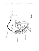 IMPLANTABLE P-WAVE DISPERSION DETECTOR diagram and image