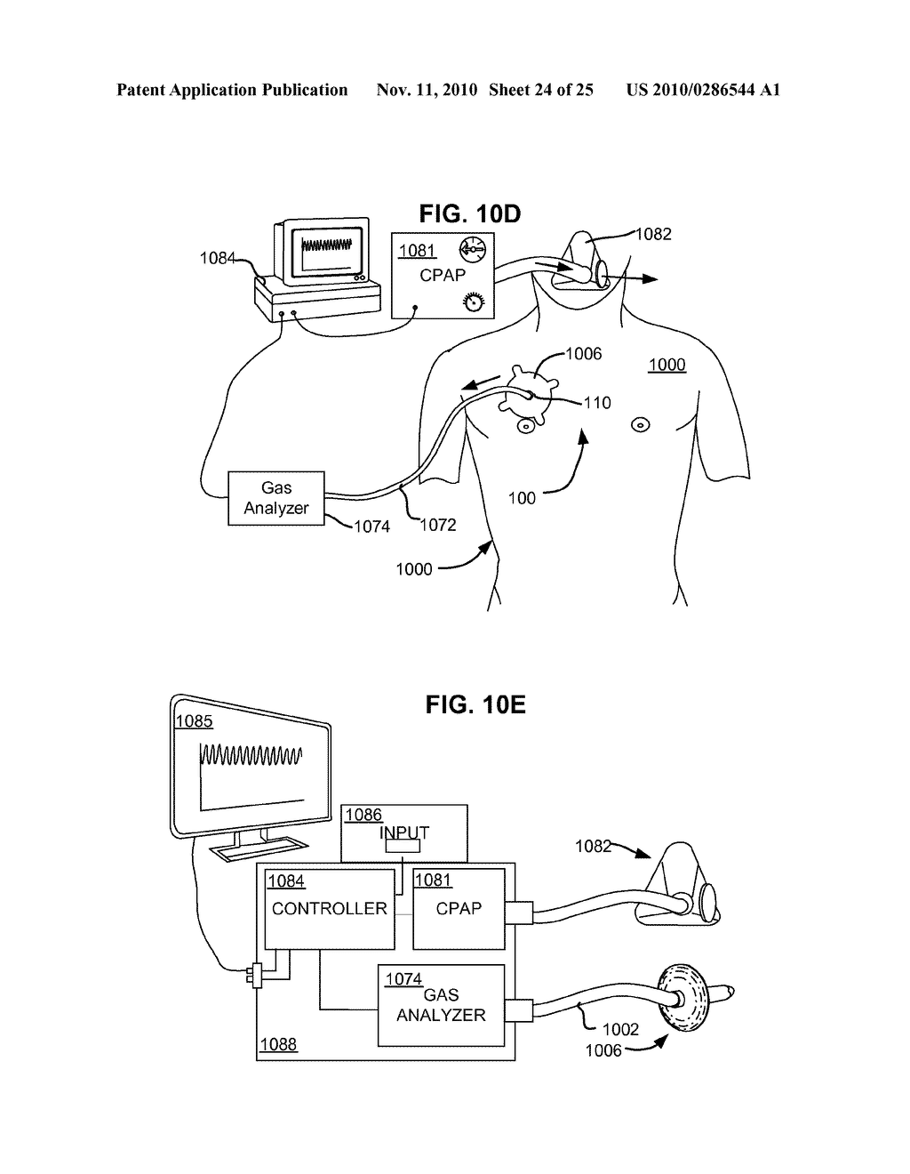 METHODS AND DEVICES FOR ASSESSMENT OF PNEUMOSTOMA FUNCTION - diagram, schematic, and image 25