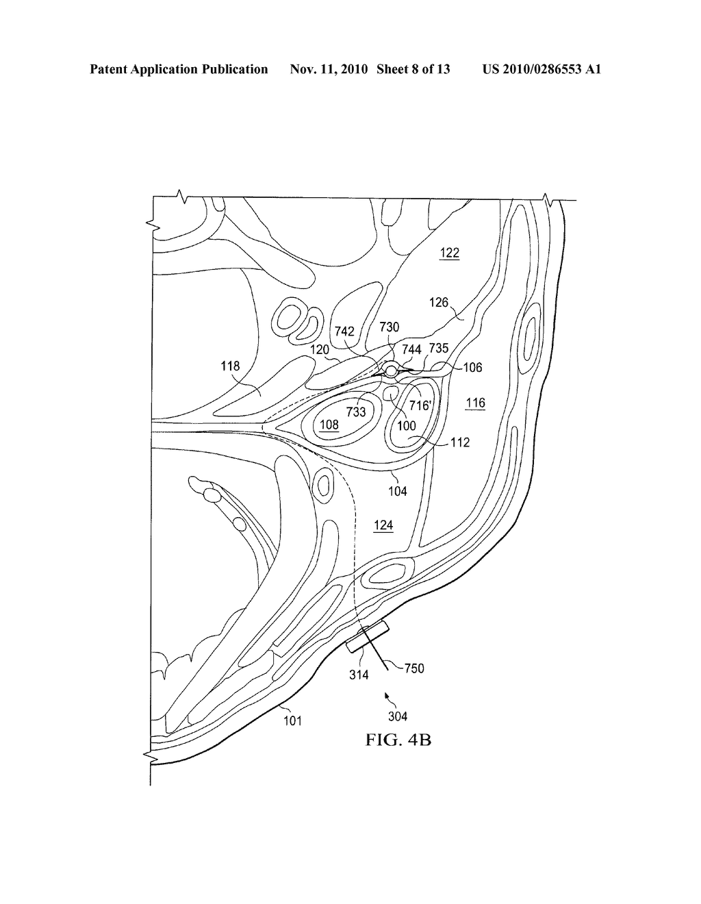 Devices and Methods for Screening of Vagal Nerve Stimulation - diagram, schematic, and image 09