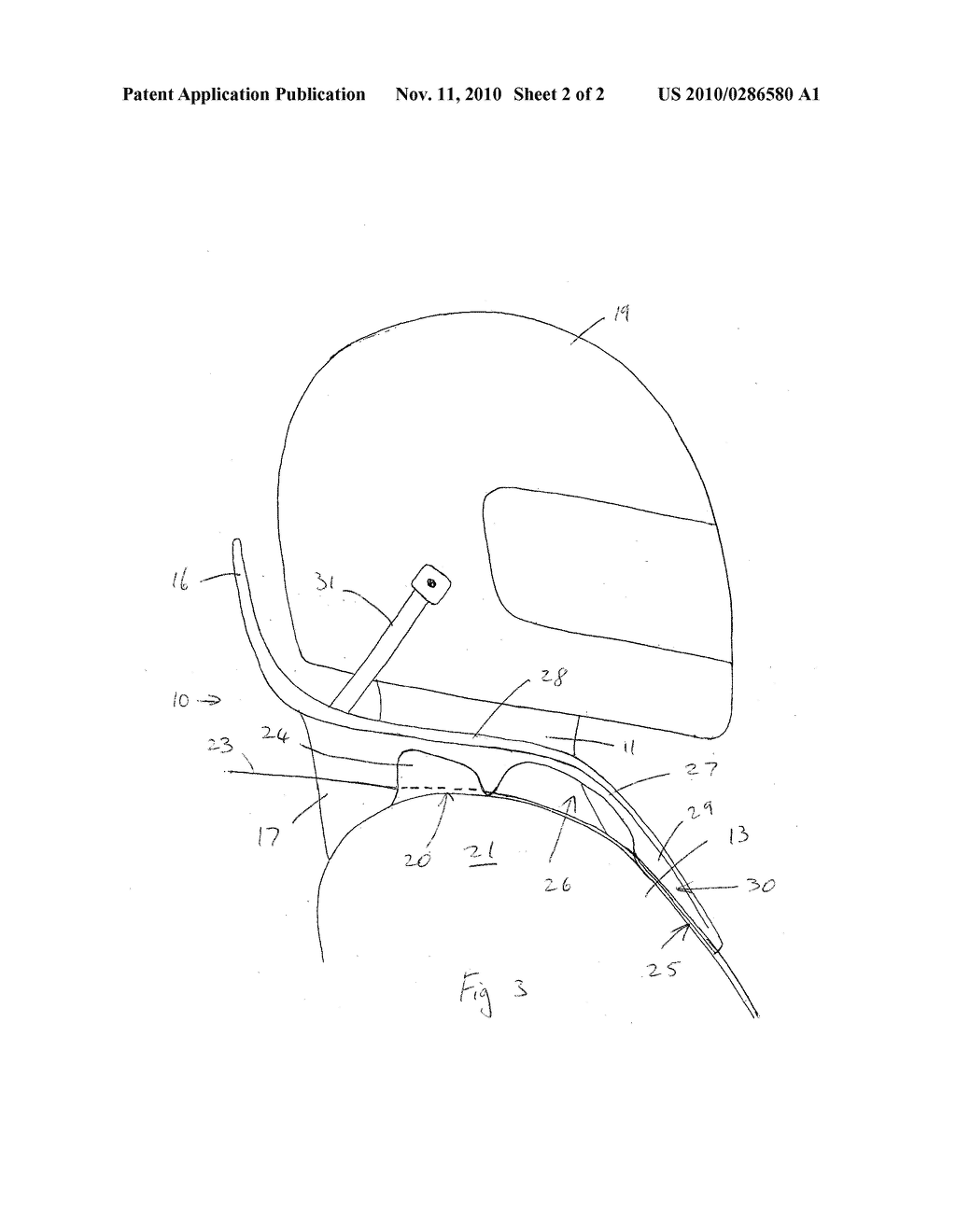 NECK BRACE - diagram, schematic, and image 03