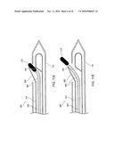 Biopsy Site Marker Deployment Device diagram and image