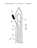 Biopsy Site Marker Deployment Device diagram and image