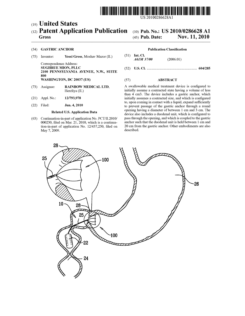 GASTRIC ANCHOR - diagram, schematic, and image 01