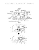 CAPSULE MEDICAL APPARATUS diagram and image