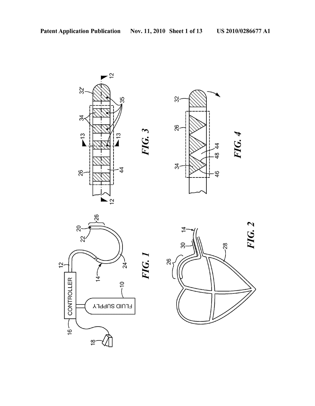 CRYOSURGICAL CATHETER - diagram, schematic, and image 02