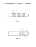 CRYOSURGICAL CATHETER diagram and image