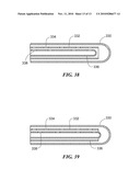 CRYOSURGICAL CATHETER diagram and image