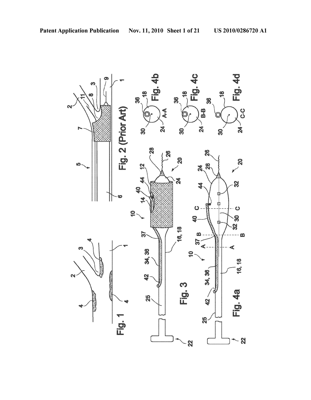 VESSEL TREATMENT DEVICES - diagram, schematic, and image 02