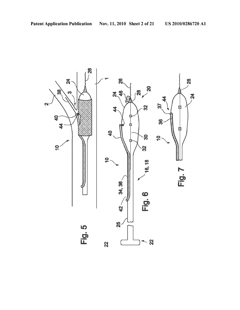 VESSEL TREATMENT DEVICES - diagram, schematic, and image 03