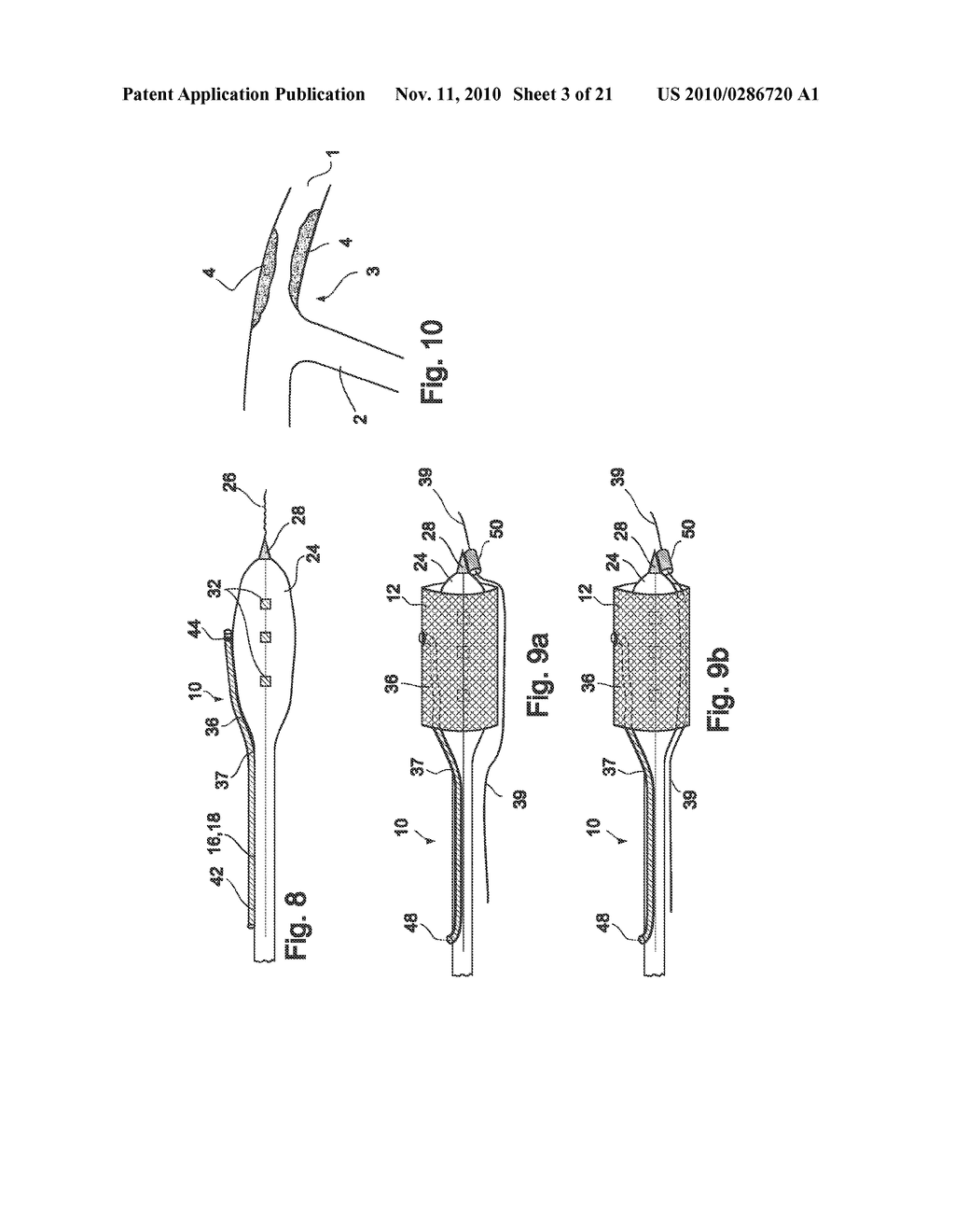 VESSEL TREATMENT DEVICES - diagram, schematic, and image 04