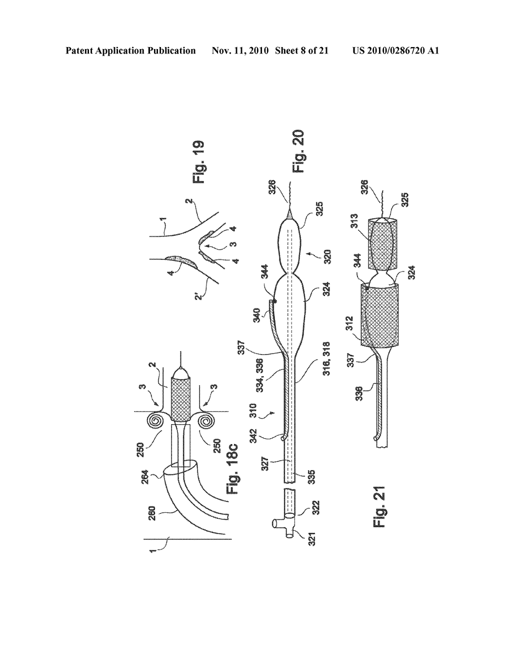 VESSEL TREATMENT DEVICES - diagram, schematic, and image 09