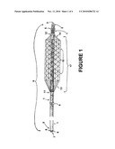 TEMPORARY VENOUS FILTER SYSTEM diagram and image