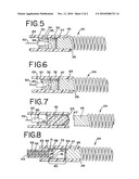 CHEMICALLY BASED VASCULAR OCCLUSION DEVICE DEPLOYMENT diagram and image