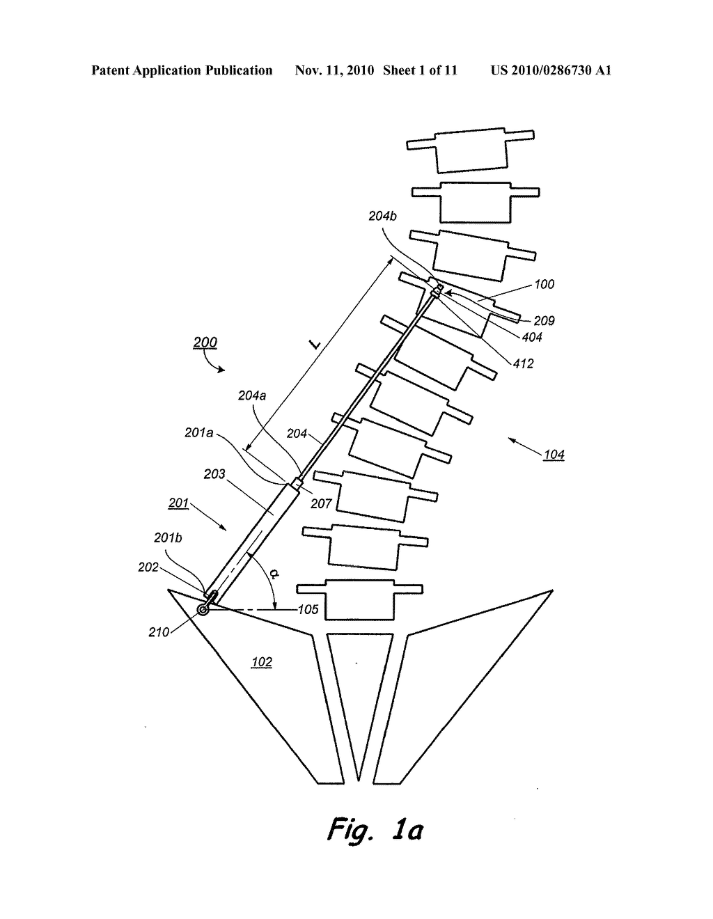 IMPLANT FOR CORRECTION OF SPINAL DEFORMITY - diagram, schematic, and image 02