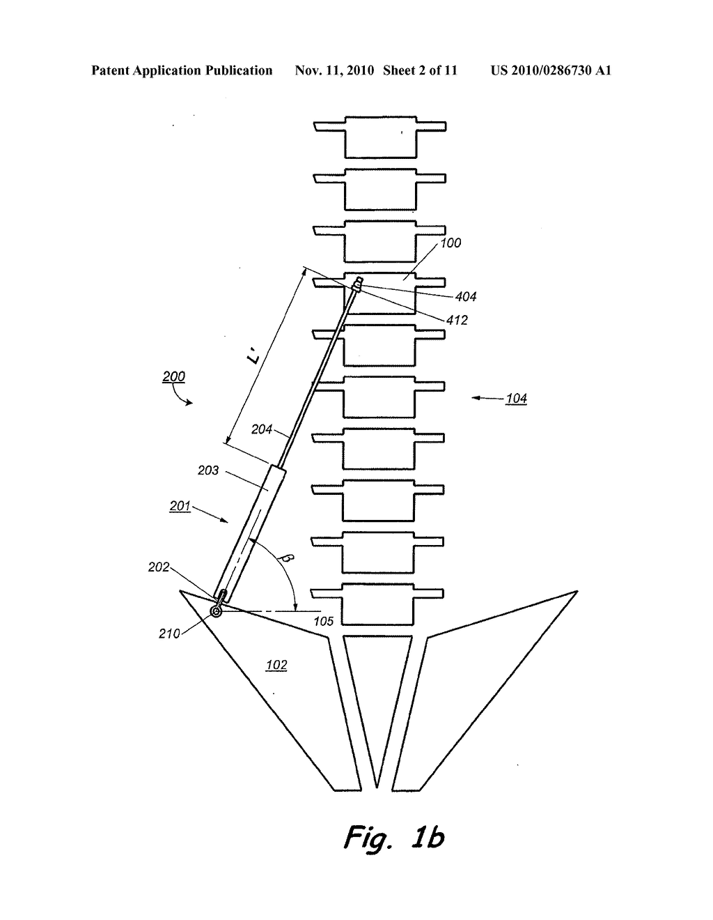 IMPLANT FOR CORRECTION OF SPINAL DEFORMITY - diagram, schematic, and image 03