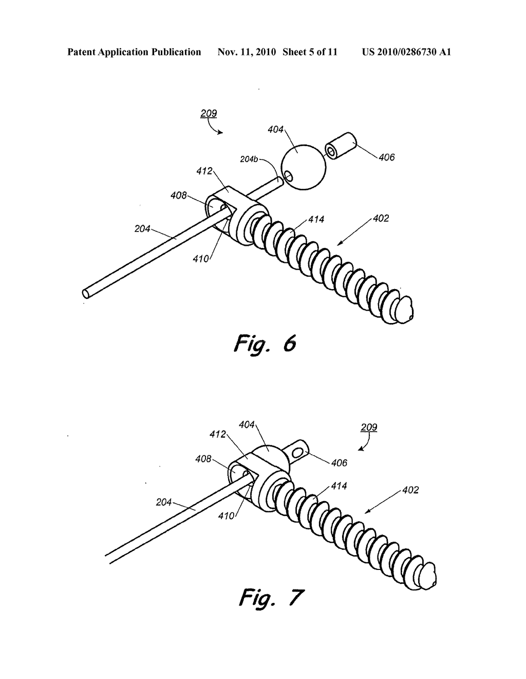 IMPLANT FOR CORRECTION OF SPINAL DEFORMITY - diagram, schematic, and image 06