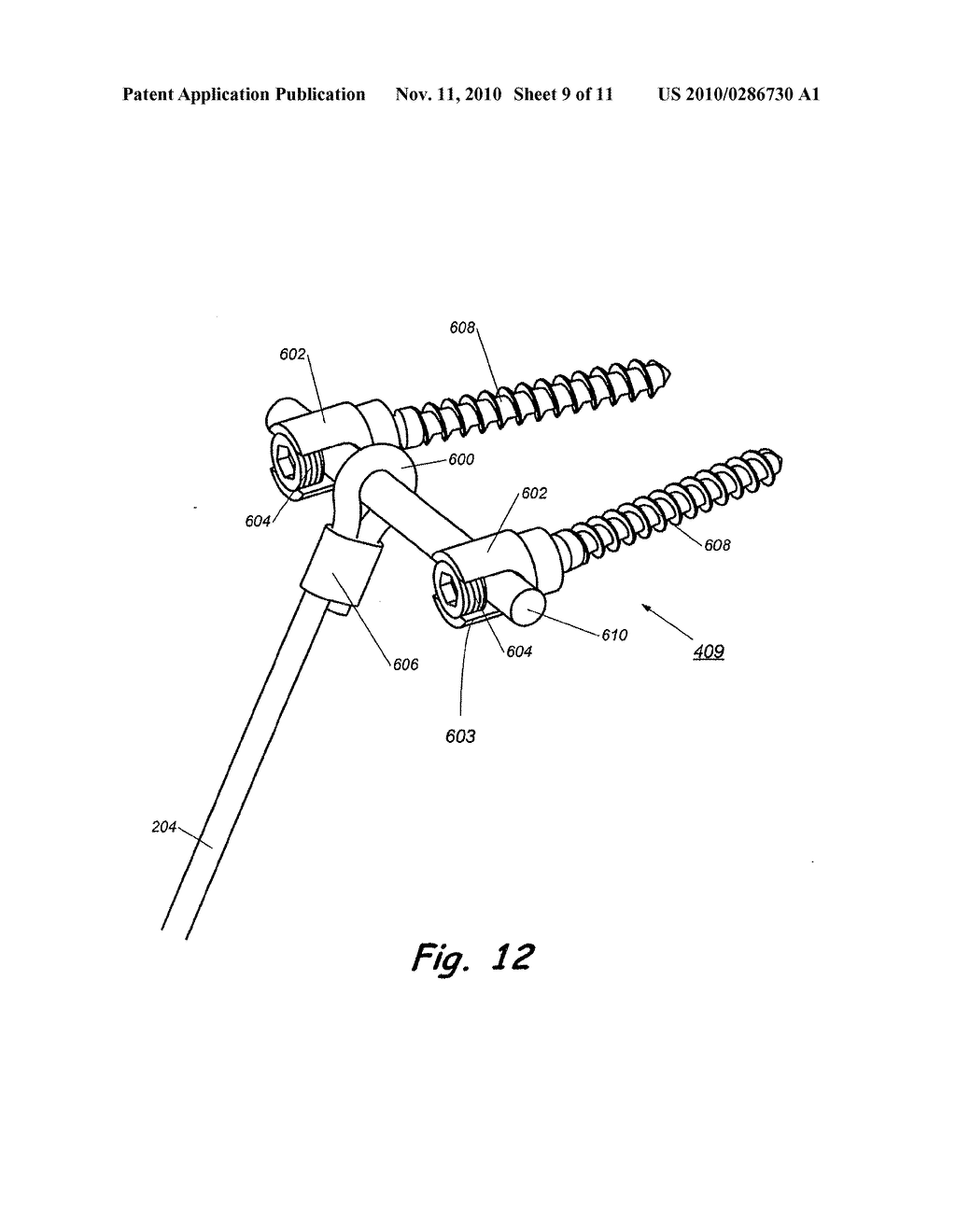 IMPLANT FOR CORRECTION OF SPINAL DEFORMITY - diagram, schematic, and image 10