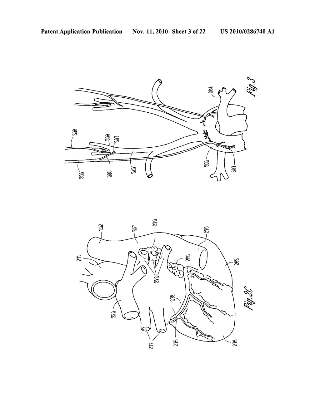 AUTOMATIC NEURAL STIMULATION MODULATION BASED ON MOTION AND PHYSIOLOGICAL ACTIVITY - diagram, schematic, and image 04