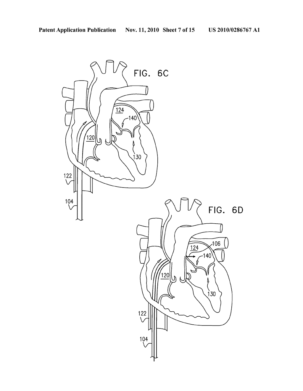 ANNULOPLASTY RING WITH INTRA-RING ANCHORING - diagram, schematic, and image 08