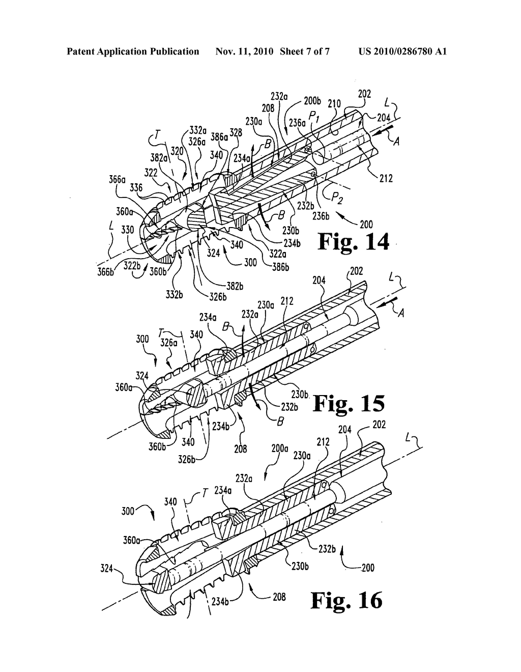 Expandable spinal fusion cage and associated instrumentation - diagram, schematic, and image 08