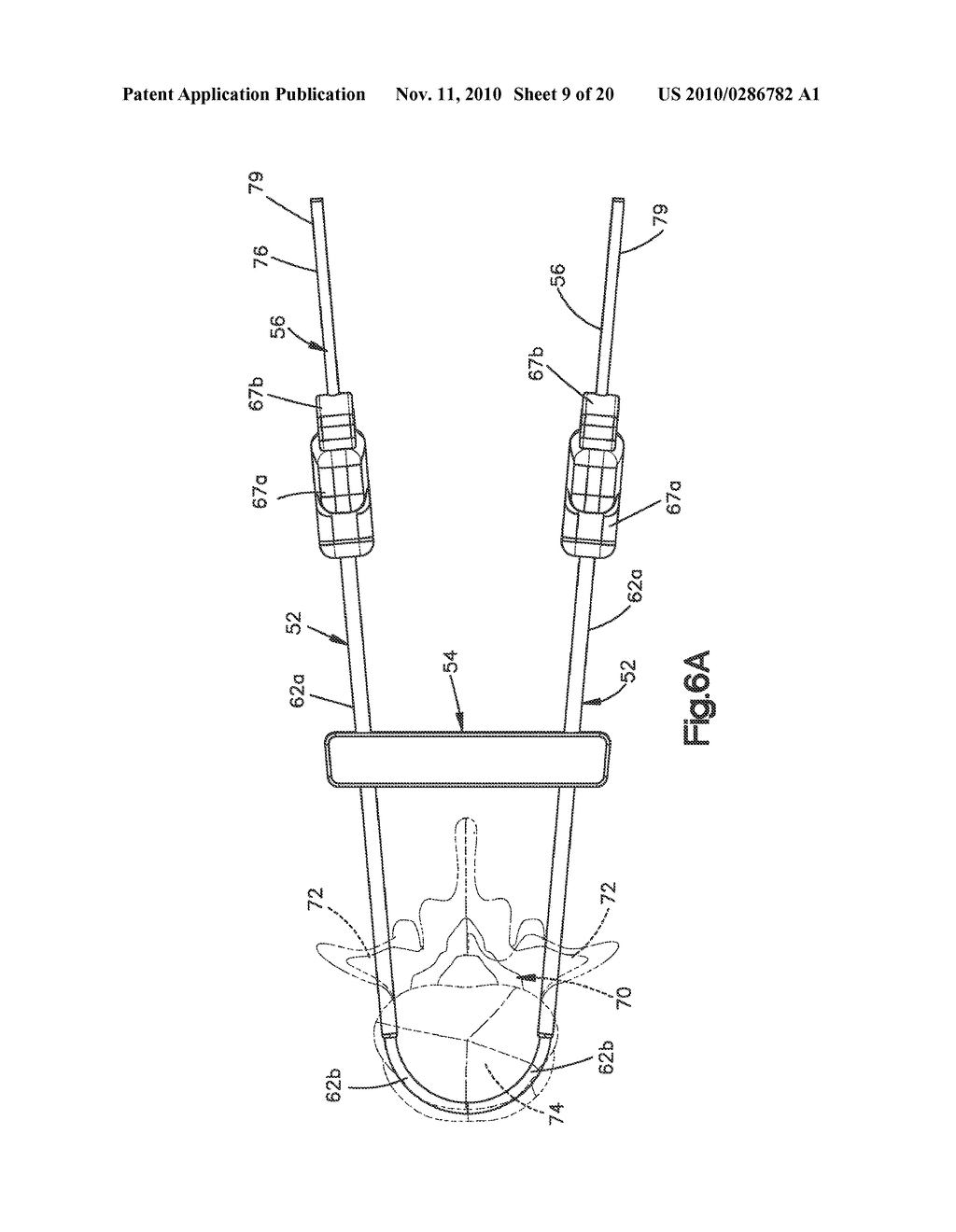 EXPANDABLE BONE IMPLANT - diagram, schematic, and image 10