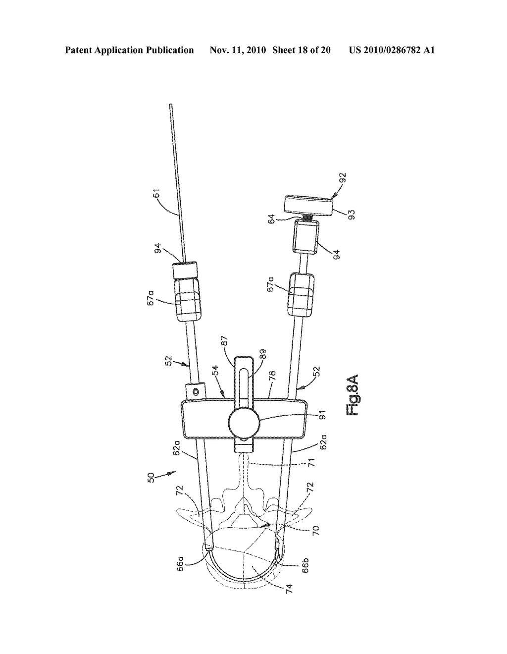 EXPANDABLE BONE IMPLANT - diagram, schematic, and image 19