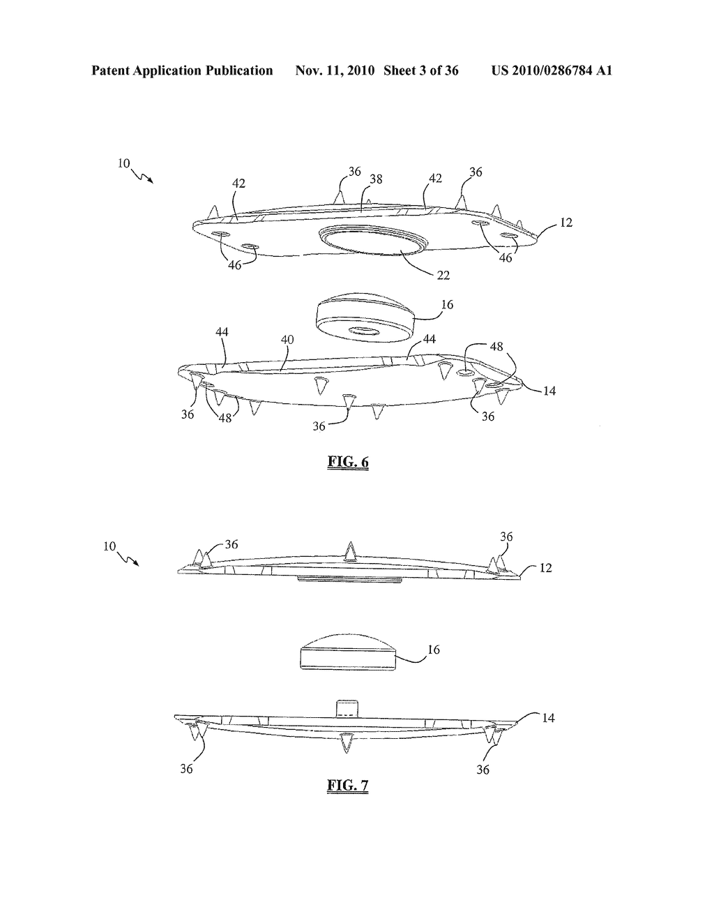 Total disc replacement system and related methods - diagram, schematic, and image 04