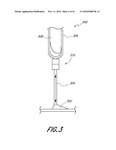 CONTROL SYSTEMS AND METHODS FOR PROSTHETIC OR ORTHOTIC DEVICES diagram and image