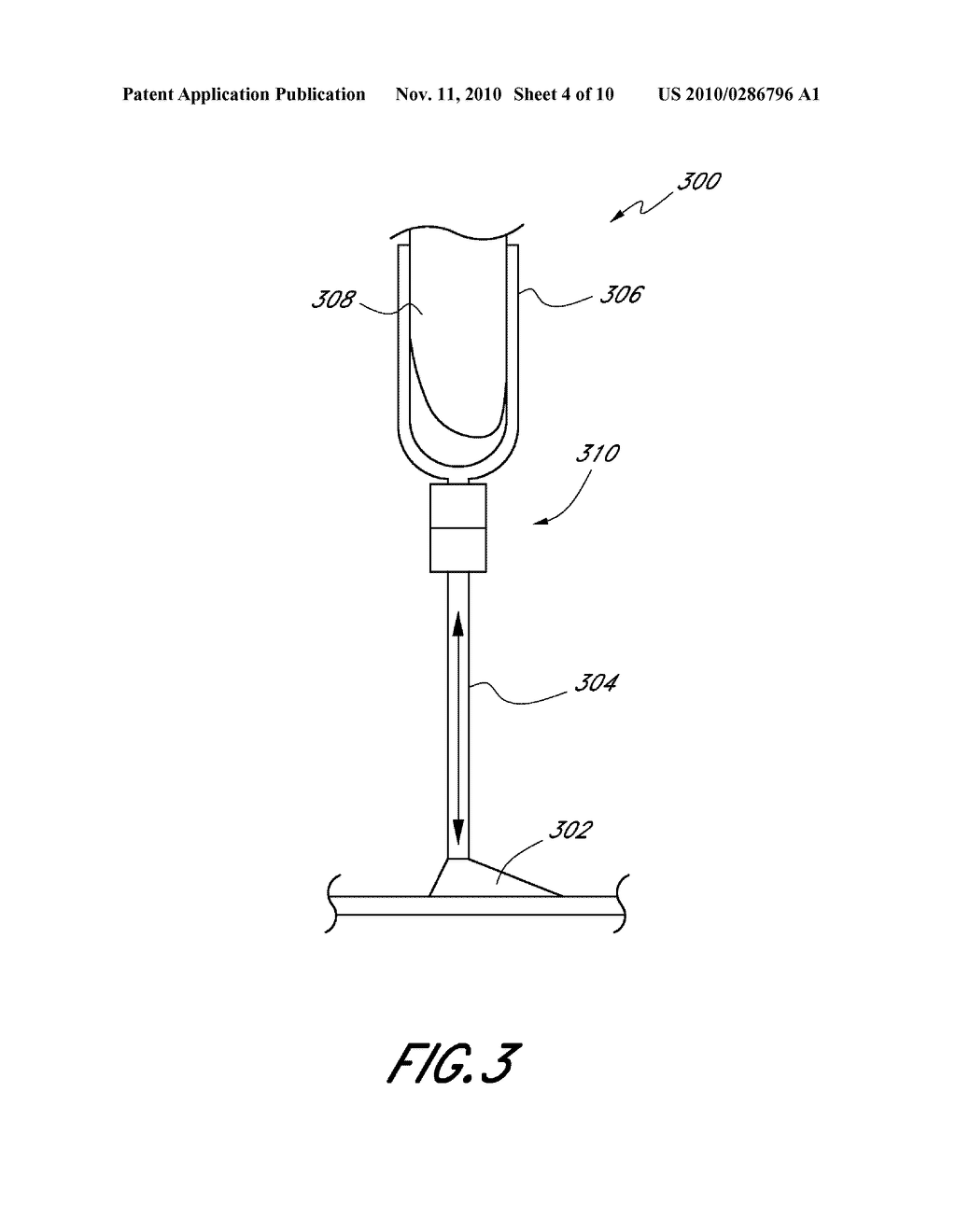 CONTROL SYSTEMS AND METHODS FOR PROSTHETIC OR ORTHOTIC DEVICES - diagram, schematic, and image 05