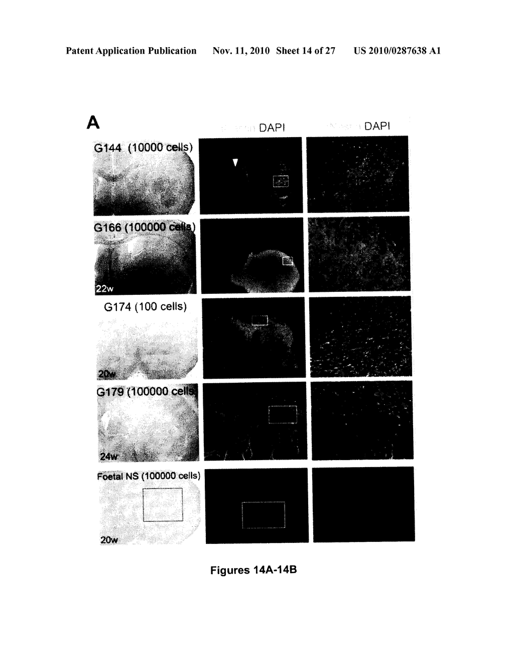 NEURAL TUMOR STEM CELLS AND METHODS OF USE THEREOF - diagram, schematic, and image 15