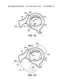 BICYCLE COMPONENT OPERATING DEVICE diagram and image