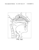 NASAL ADMINISTRATION diagram and image