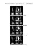 COMPOSITIONS FOR TREATING PARKINSON S DISEASE diagram and image