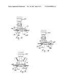 Respiratory Access Port Assembly With Passive Lock And Method Of Use diagram and image