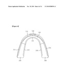 TEMPOROMANDIBULAR JOINT BALANCING APPLIANCE AND METHOD FOR USING THE SAME diagram and image