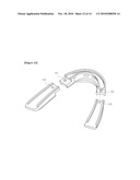 TEMPOROMANDIBULAR JOINT BALANCING APPLIANCE AND METHOD FOR USING THE SAME diagram and image