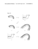 TEMPOROMANDIBULAR JOINT BALANCING APPLIANCE AND METHOD FOR USING THE SAME diagram and image