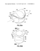 Density Phase Separation Device diagram and image