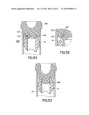 Density Phase Separation Device diagram and image