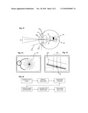 Electronic ophthalmoscope for selective retinal photodisruption of the photoreceptor mosaic diagram and image