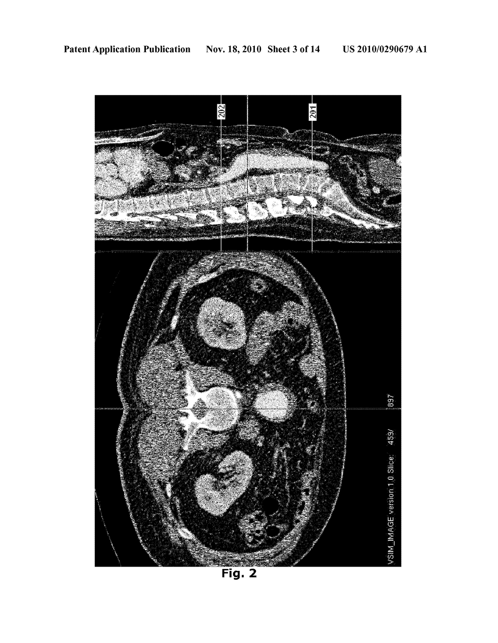 AUTOMATIC GEOMETRICAL AND MECHANICAL ANALYZING METHOD AND SYSTEM FOR TUBULAR STRUCTURES - diagram, schematic, and image 04