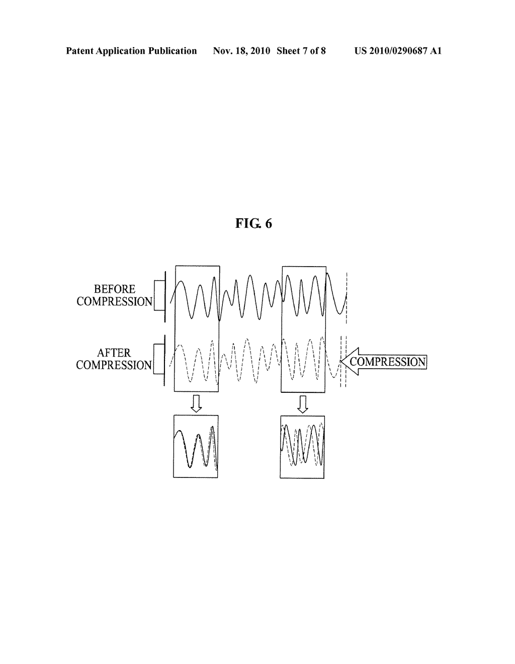 Apparatus And Methods For Displaying An Elastic Image Using An Ultrasound System - diagram, schematic, and image 08